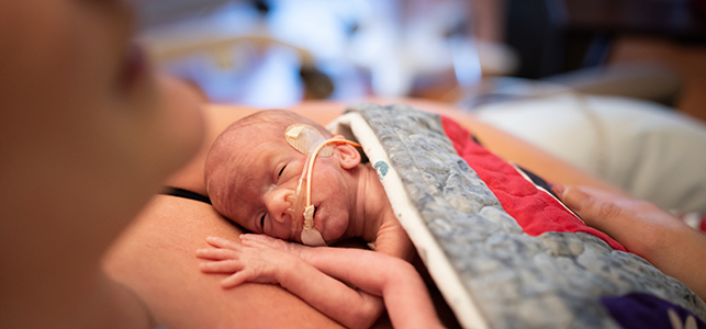 Close of up premature baby doing skin to skin with mother