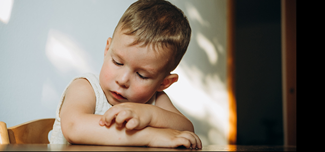 Don’t let eczema get under your skin