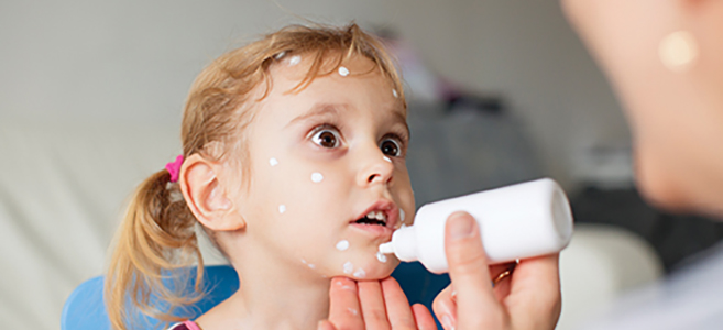 What’s that rash? Decoding some of the most common skin concerns in kids